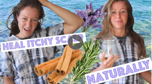 Itchy scalp remedy natural effective <4 — Steemit.png